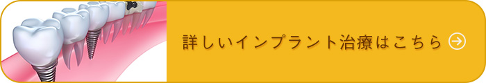 詳しいインプラント治療はこちら